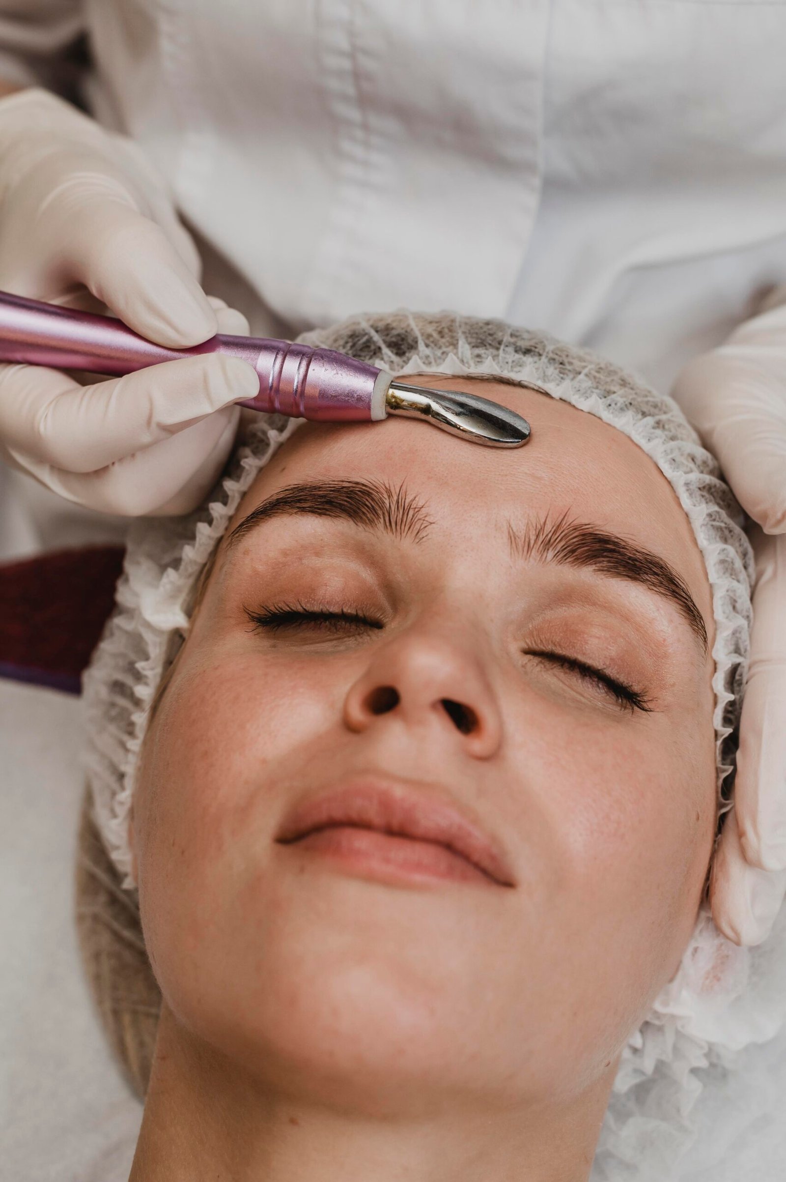 Microchanneling Treatment